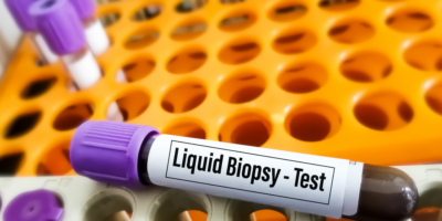 Genome-Based Diagnostics Announces Planned Launch of Liquid Biopsy Testing