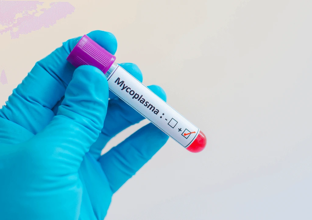 Scientist holding test tube labeled mycoplasma